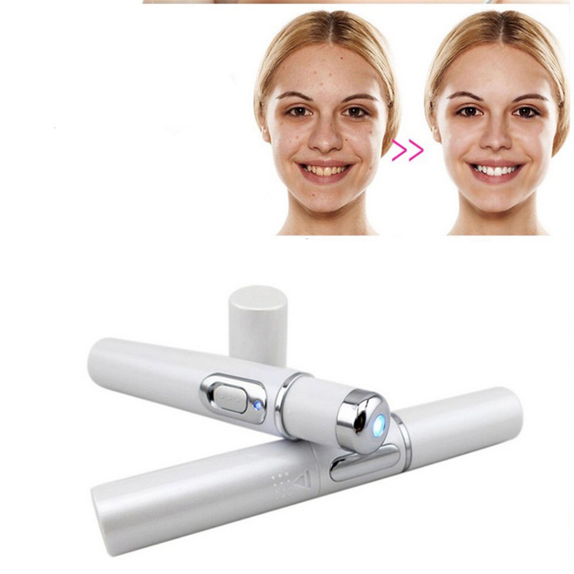 Wrinkle Blemish Pore Acne Scar Remover Pen - TrendSetDas